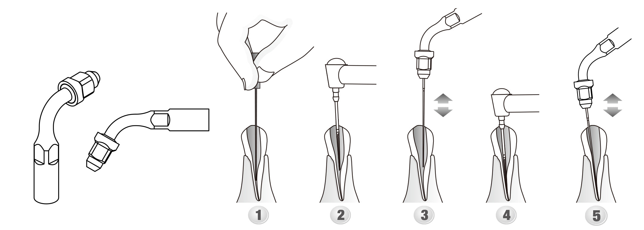 DTE Endo Tips (singles) (4440339382359)